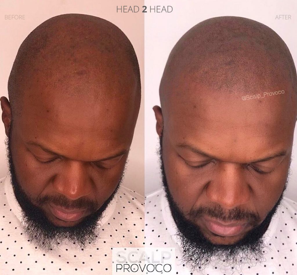 head 2 head SMP blog