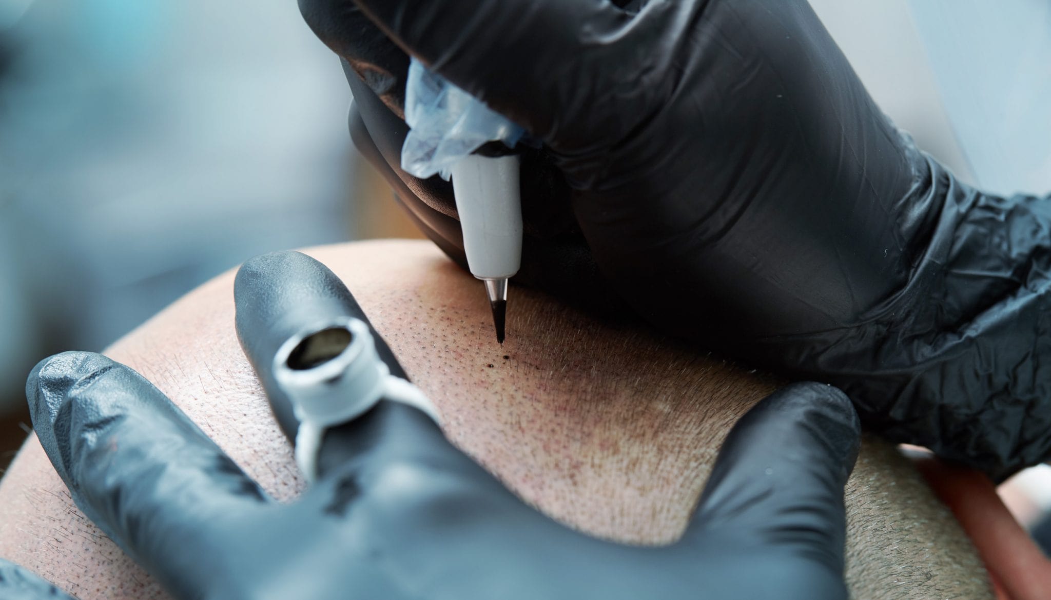Is Scalp Micropigmentation A Tattoo