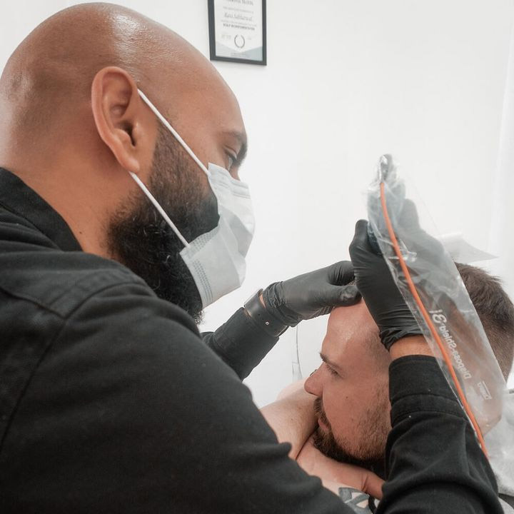 Ravi Scalp Provoco 2