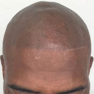 After Smp Dark Brown Skin Mens