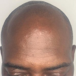 Before Smp Dark Brown Skin Mens