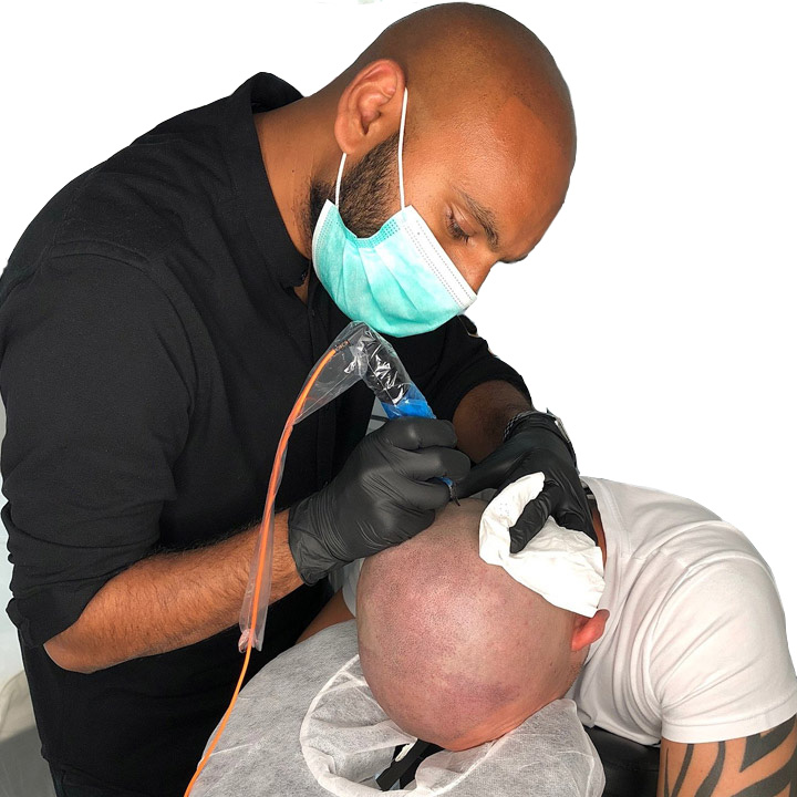 Ravi Smp Scar Coverage
