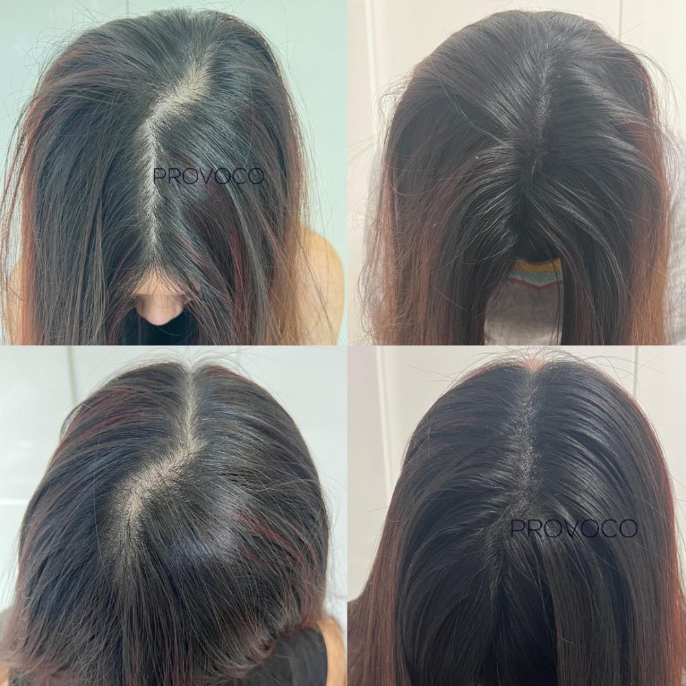 Hair parting SMP woman dark hair